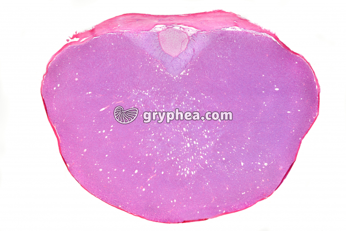 Hypophyse humaine CS x 2 - gryphea.com